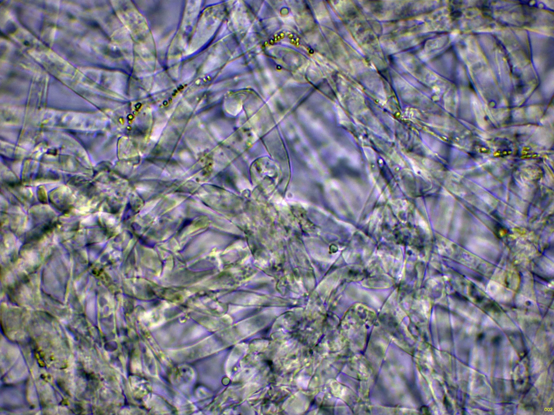 Microscopía de Leucopaxillus compactus - 10 - Subpellis agua-002